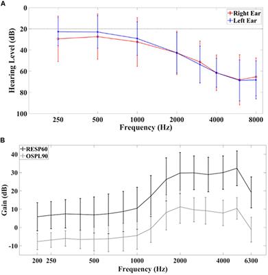 Hearing Aids Do Not Alter Cortical Entrainment to Speech at Audible Levels in Mild-to-Moderately Hearing-Impaired Subjects